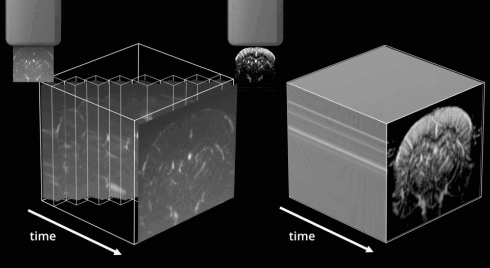 What is Functional Ultrasound (fUS)?